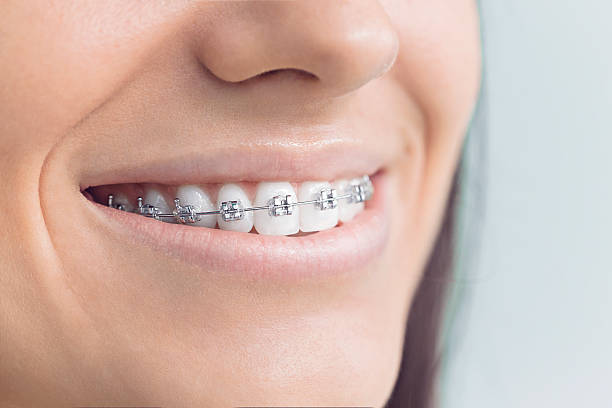 Best Wisdom Tooth Removal  in Rocklin, CA